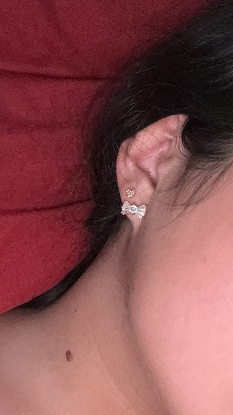 Customer photo review of Acero Quirúrgico Dorado Con Zirconias Primera Perforación