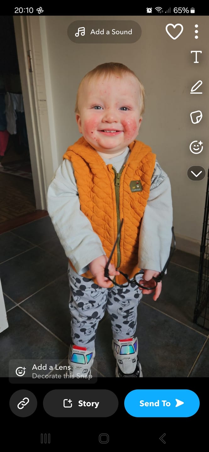 Customer photo review of Bioskin Junior Duo Pack