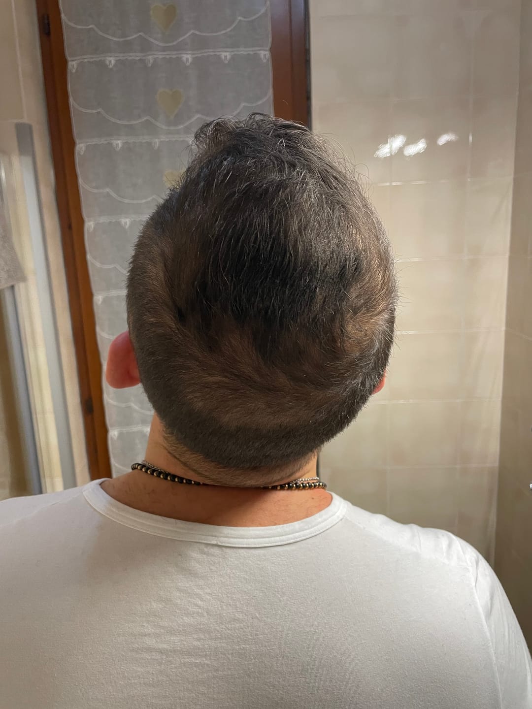Customer photo review of Fibre copri Calvizie da 12gr  | Castano Scuro | 30 Giorni di applicazioni