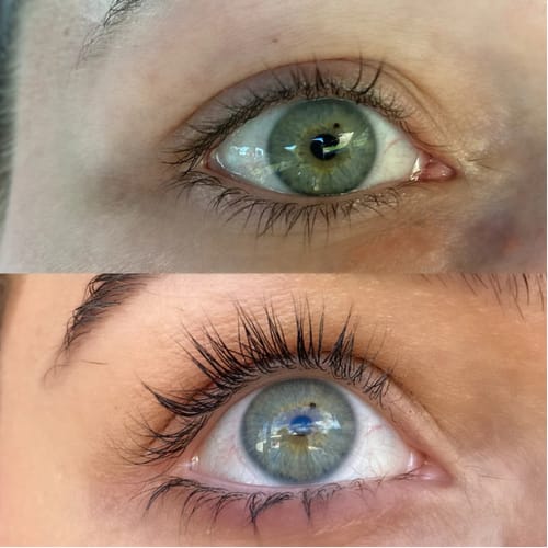 Customer photo review of COSTIQ® LASH SERUM