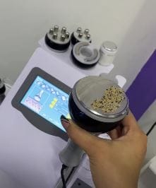 Customer photo review of 30K Cavitation Machine 6 in 1 for Fat Blasting