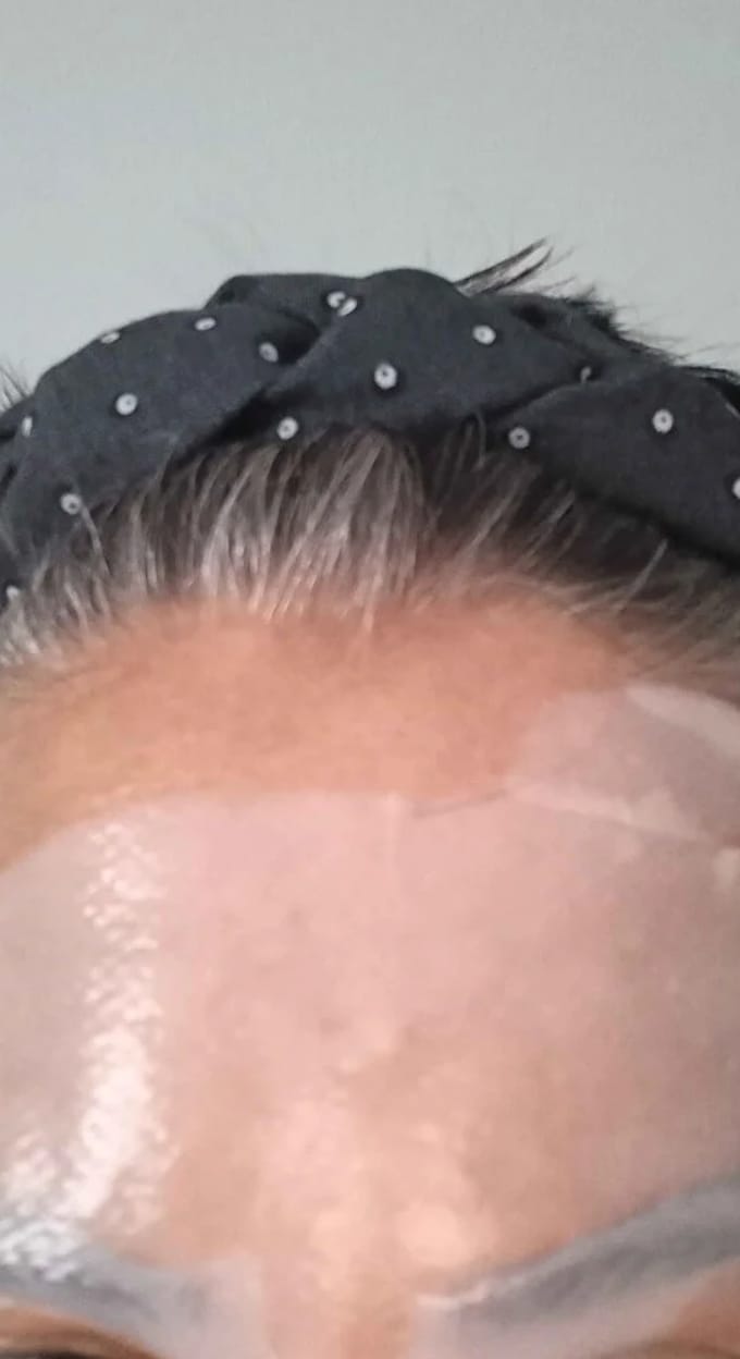 Customer photo review of Liarina® Bio Kolajen Maske