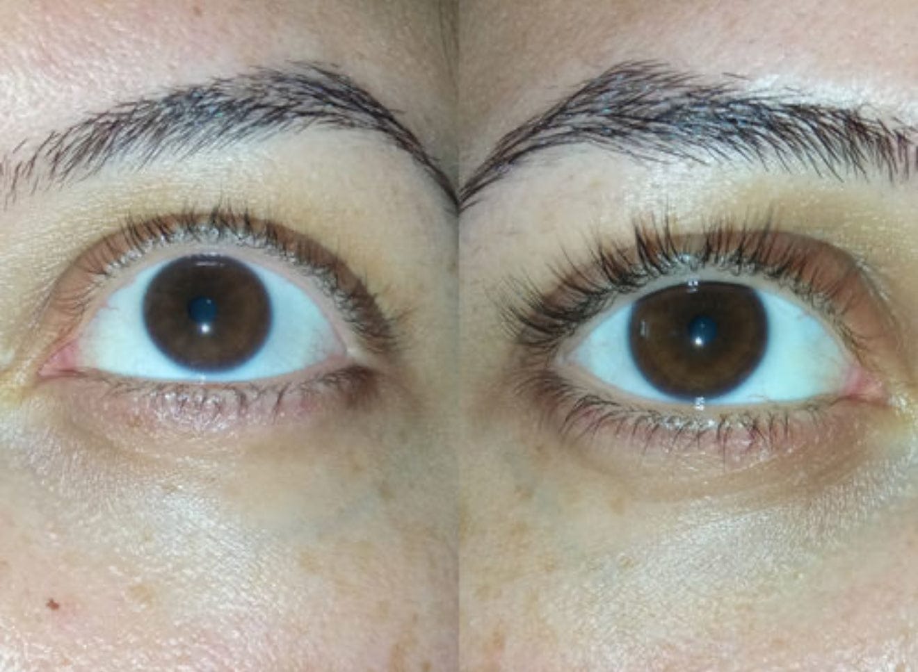Customer photo review of Eyelash Growth Serum