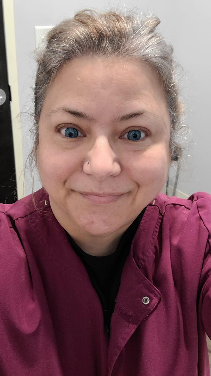 Customer photo review of New York Blue Prescription Colored Contact Lenses