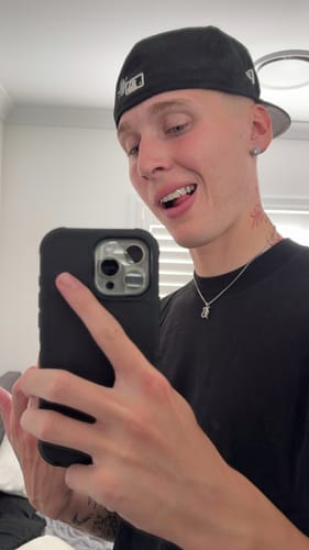 Customer photo review of SPARK (SILVER GRILLZ)