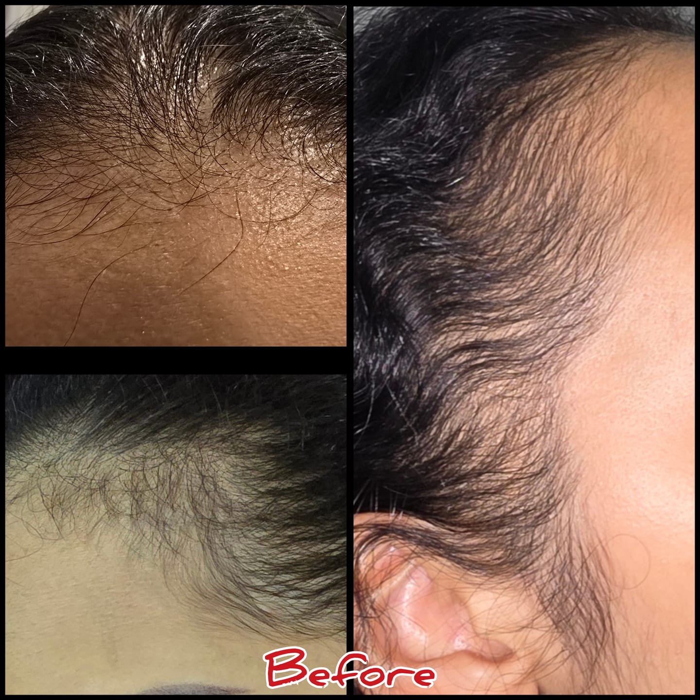 Customer photo review of Hair Loss Prevention Kit