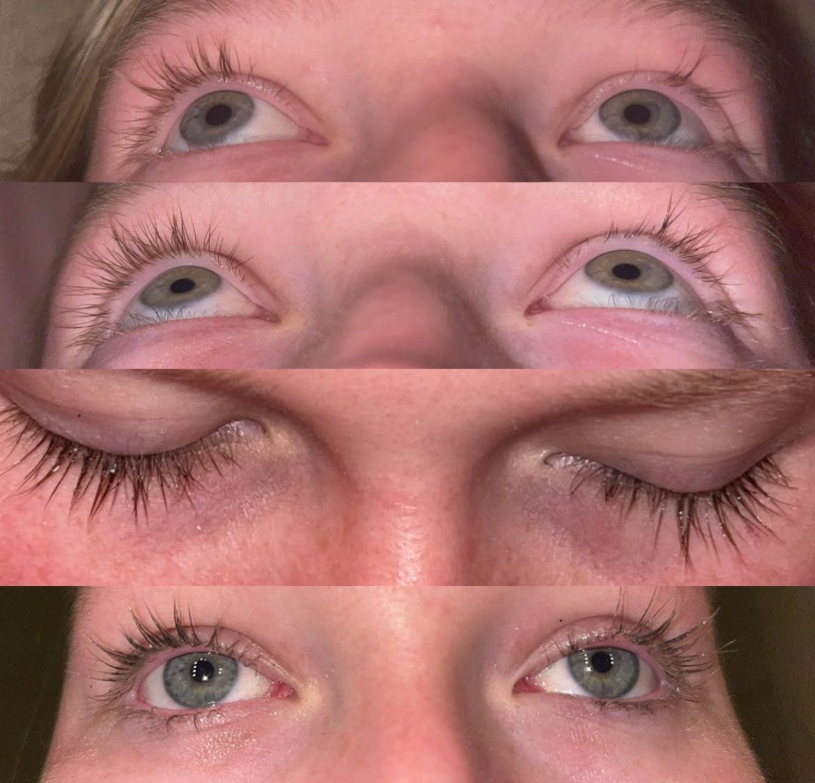 Customer photo review of Eyelash Growth Serum