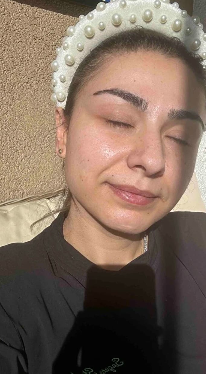 Customer photo review of Liarina® Bio Kolajen Maske