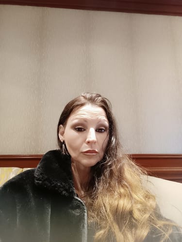 Customer photo review of LipFix: LipFlip