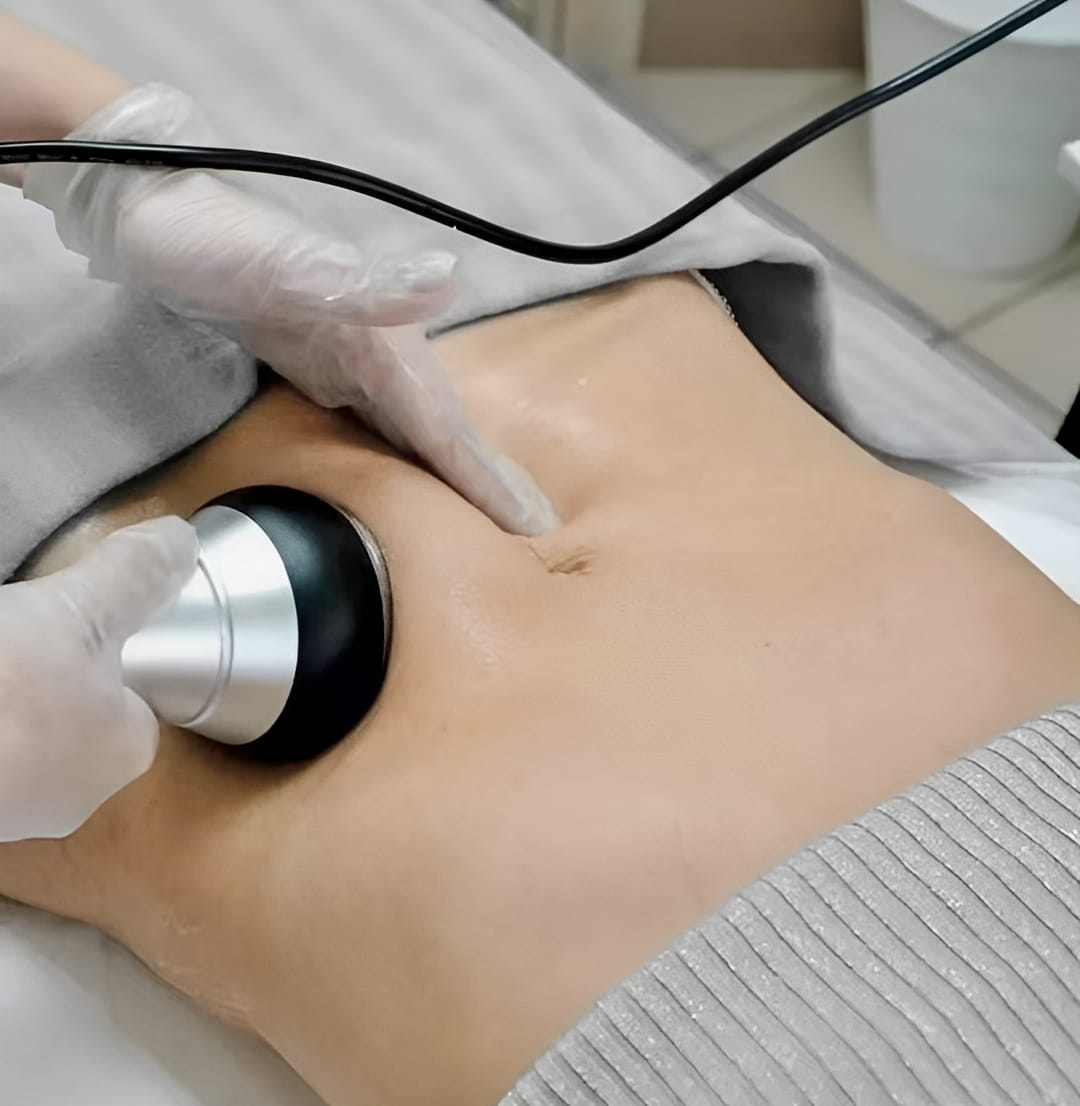 Customer photo review of 30K Cavitation Machine 6 in 1 for Fat Blasting