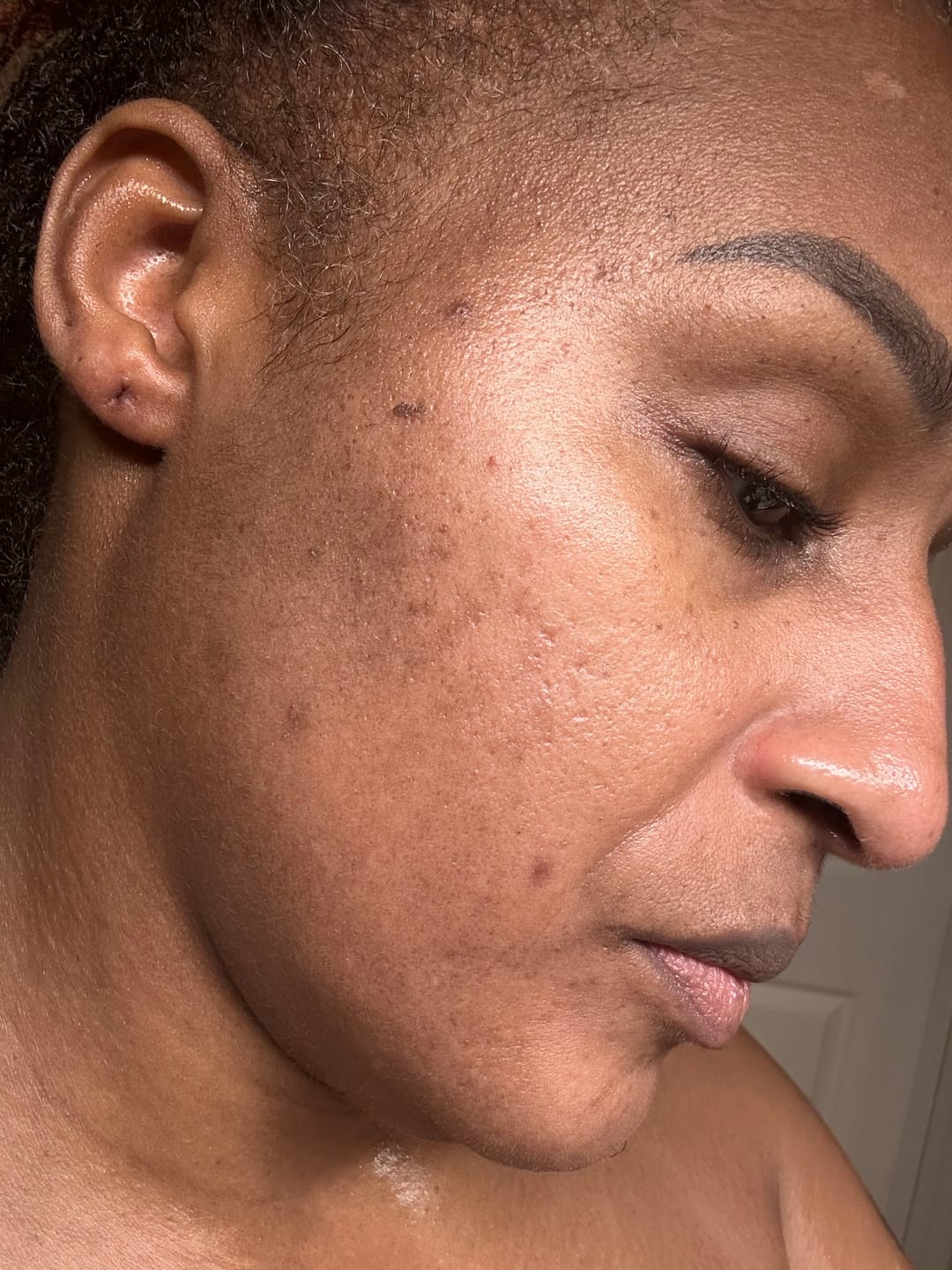 Customer photo review of Turmeric and Kojic Foaming Face Wash