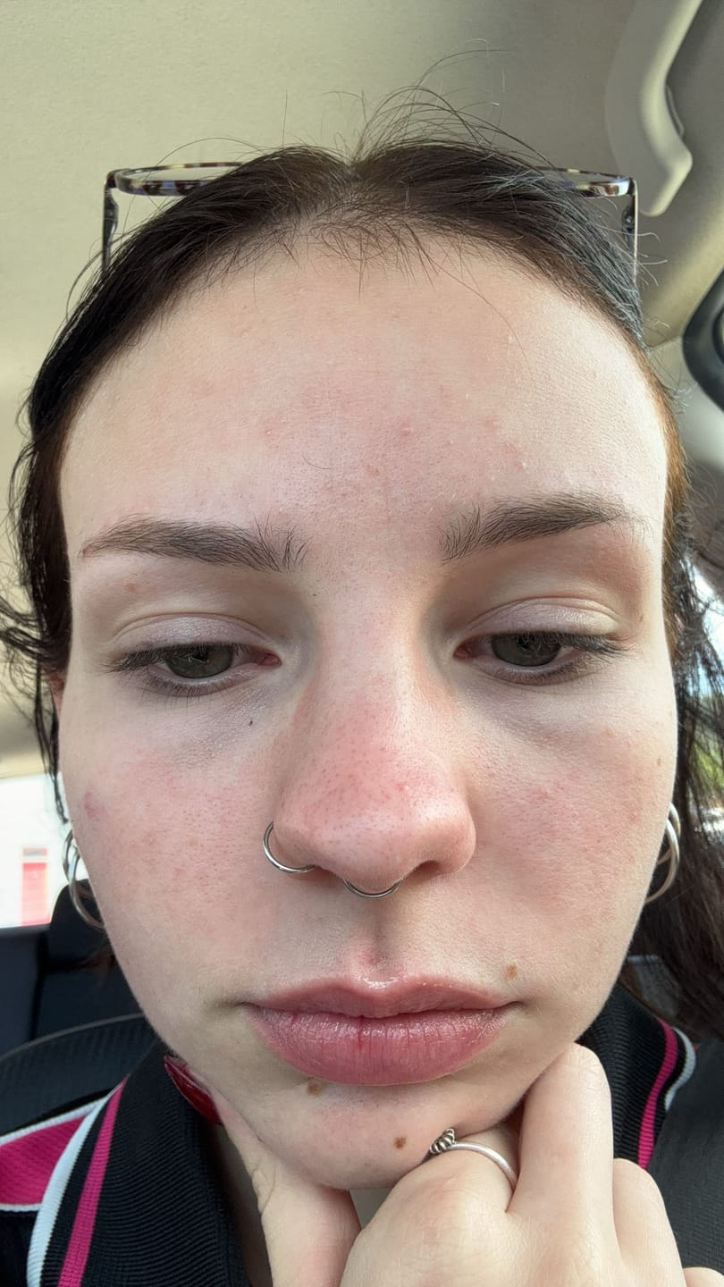 Customer photo review of Peptide + Probiotic Face Cream (New and Improved)
