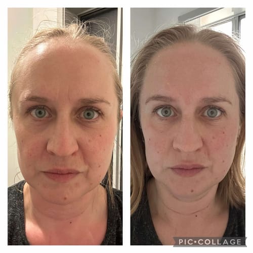 Customer photo review of The Naked Skin Bio-Collagen Mask