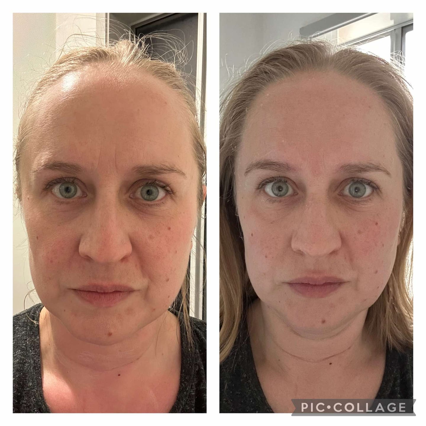 Customer photo review of The Naked Skin Bio-Collagen Mask