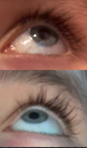 Customer photo review of Lash Growth Serum