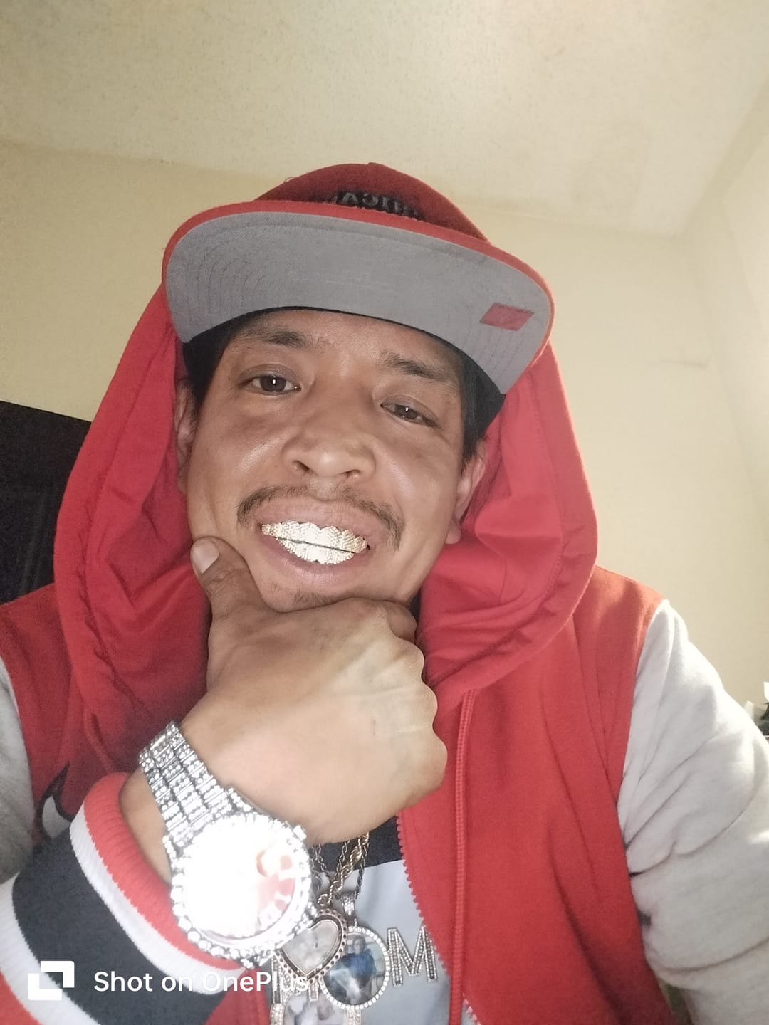 Customer photo review of 8 Tooth Standard Iced Grillz - Gold