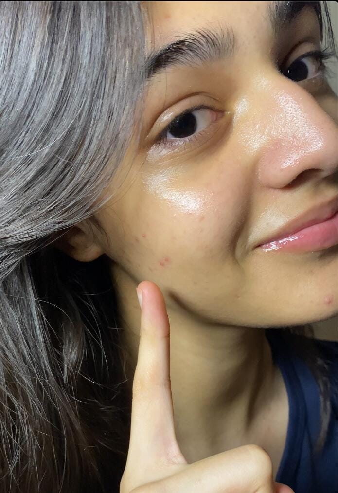 Customer photo review of Jericho Rose Mist Serum Glow Spray