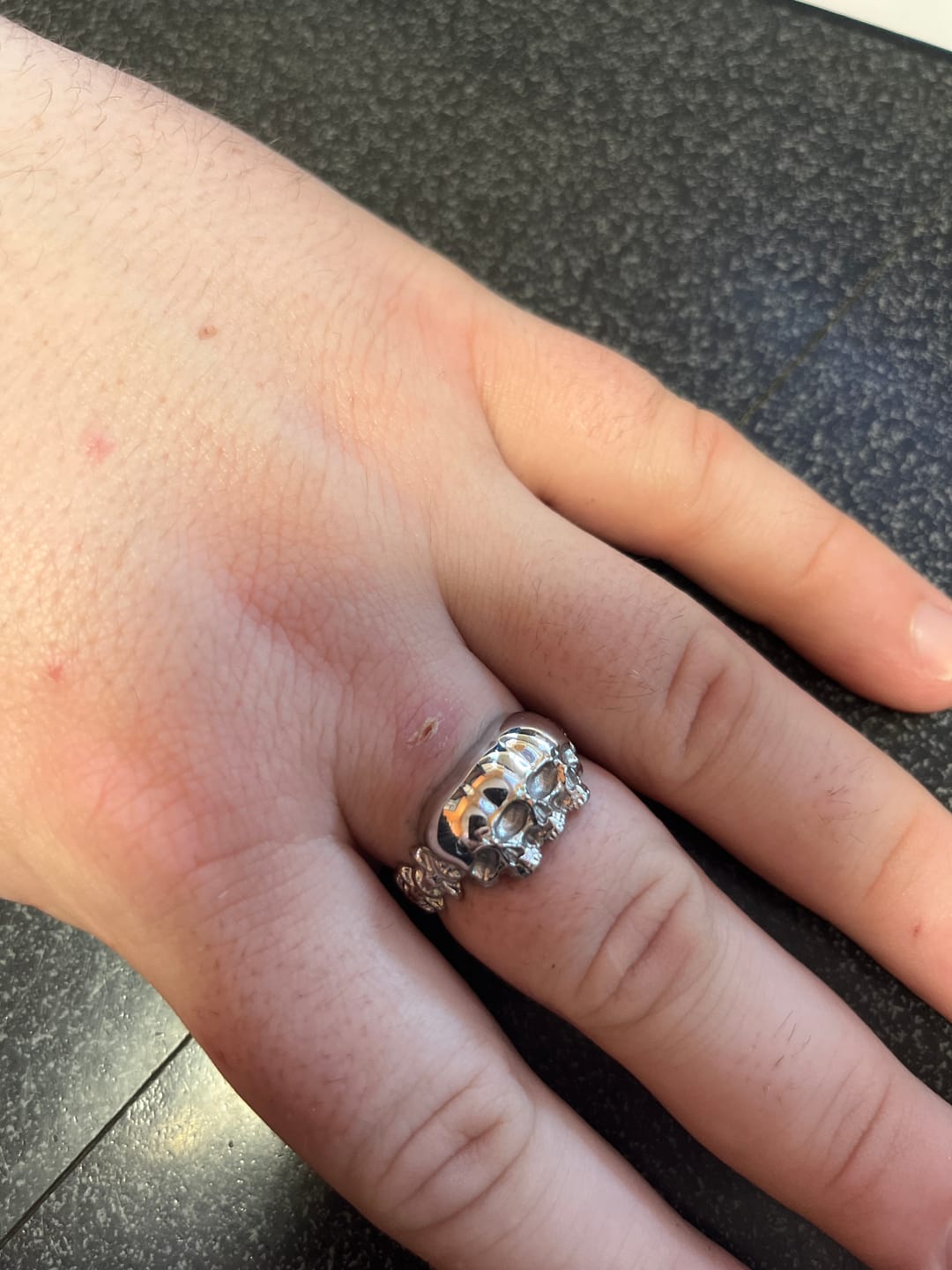Customer photo review of TRIPLE THREAT RING