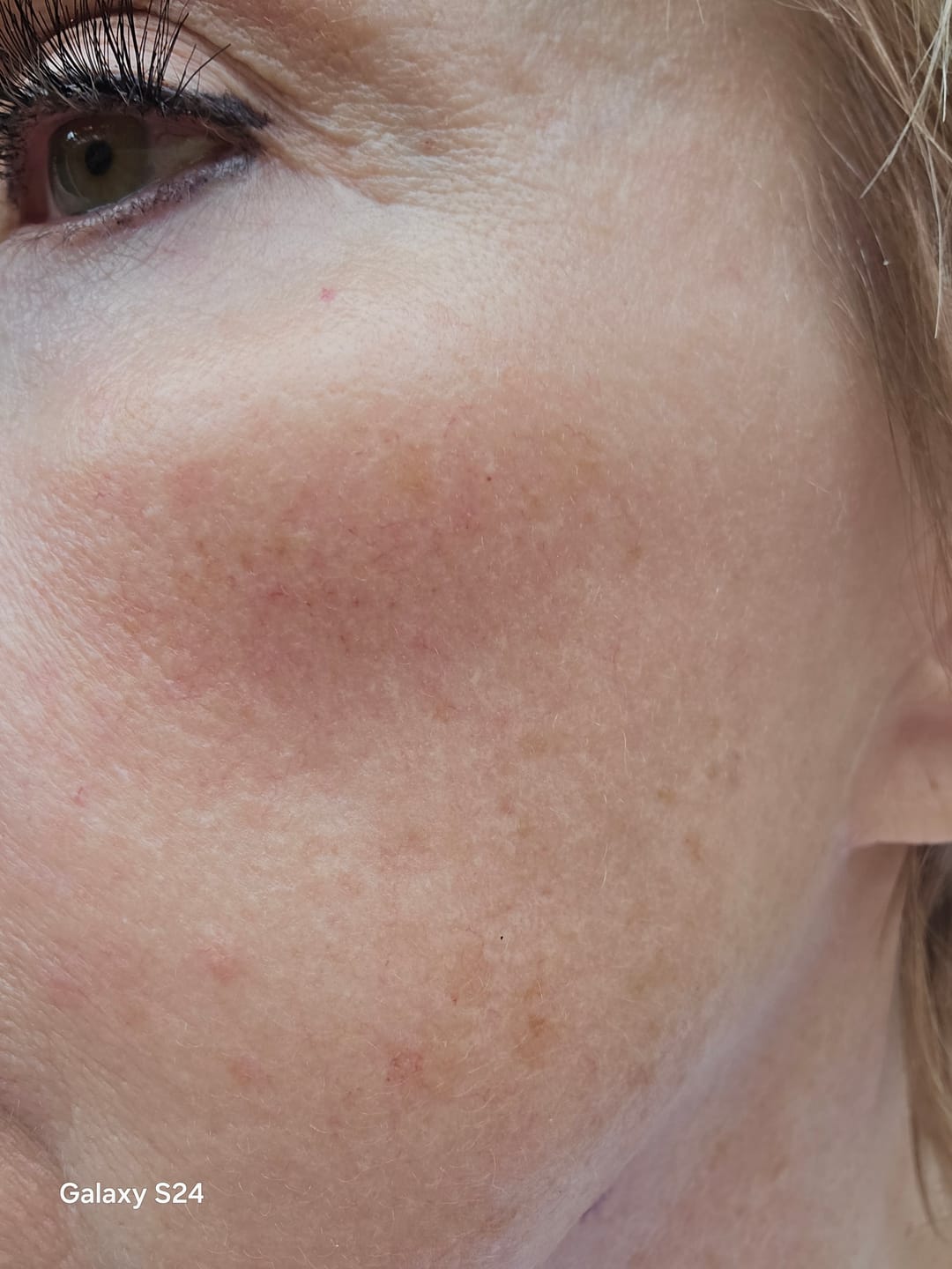 Customer photo review of aspenglow / restorative face whip