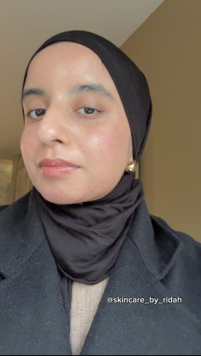 Customer photo review of Jericho Rose Mist Serum Glow Spray