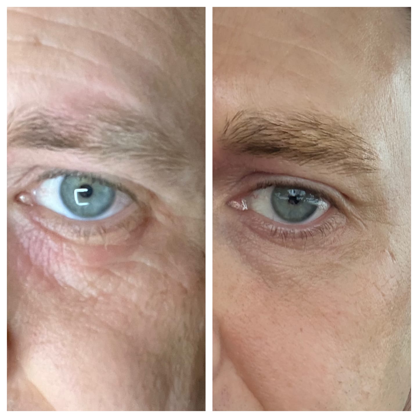 Customer photo review of Anti-Age & Glow Ritual