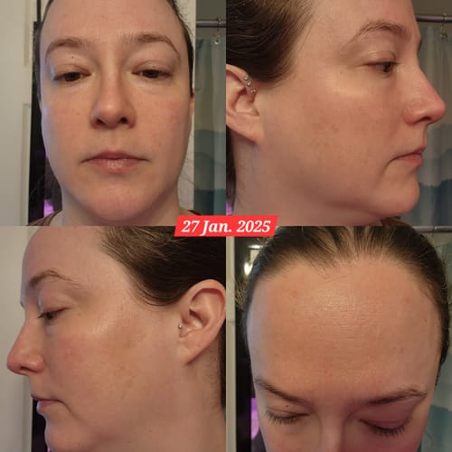 Customer photo review of Neptune Grass Fed Tallow & Honey Balm