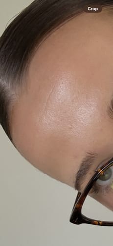 Customer photo review of Anua - Heartleaf Pore Control Cleansing Oil