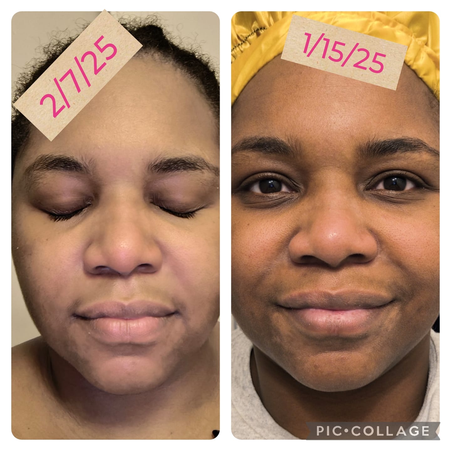 Customer photo review of Exfoliating Soap