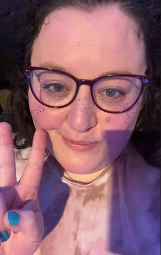 Customer photo review of Rose Gold Stardust Speckles Makeup Patches