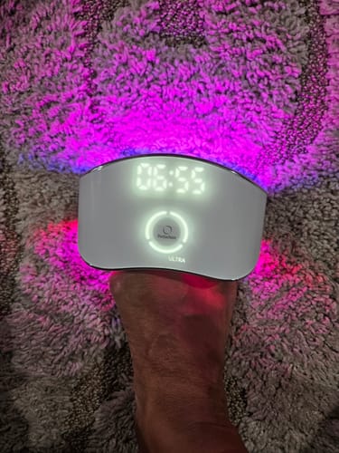 Customer photo review of Pentachom SE Antifungal Laser Program