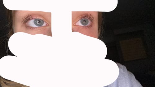 Customer photo review of NEW AND IMPROVED Lash Growth Serum