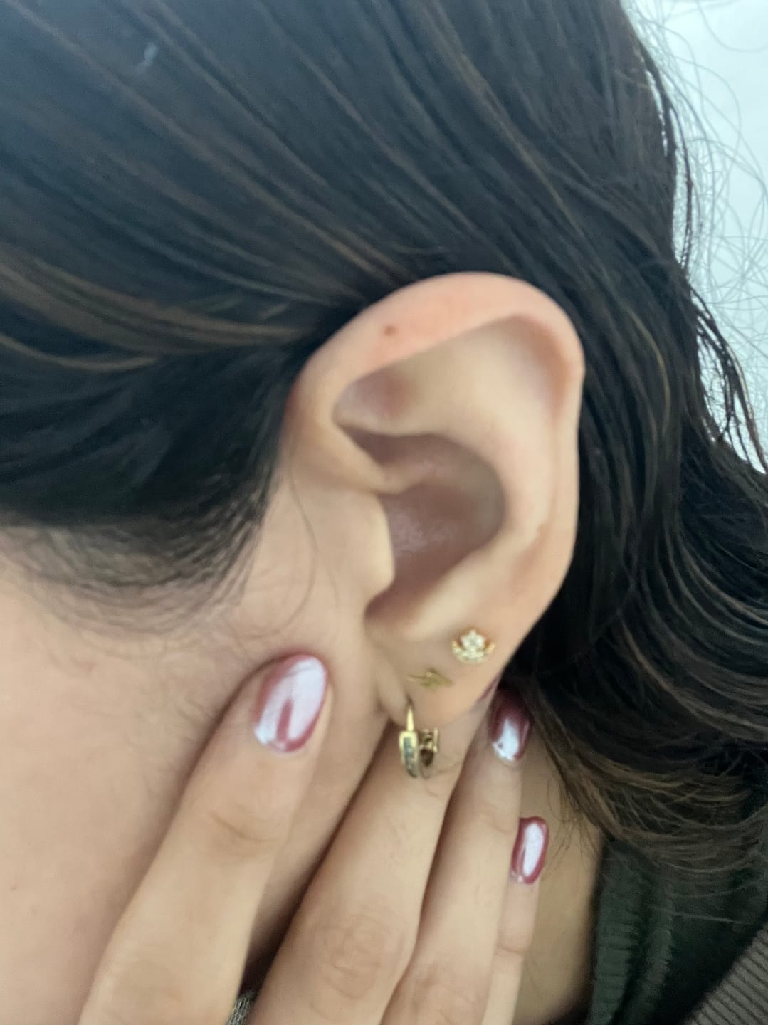 Customer photo review of Acero Quirúrgico Dorado Con Zirconias Primera Perforación