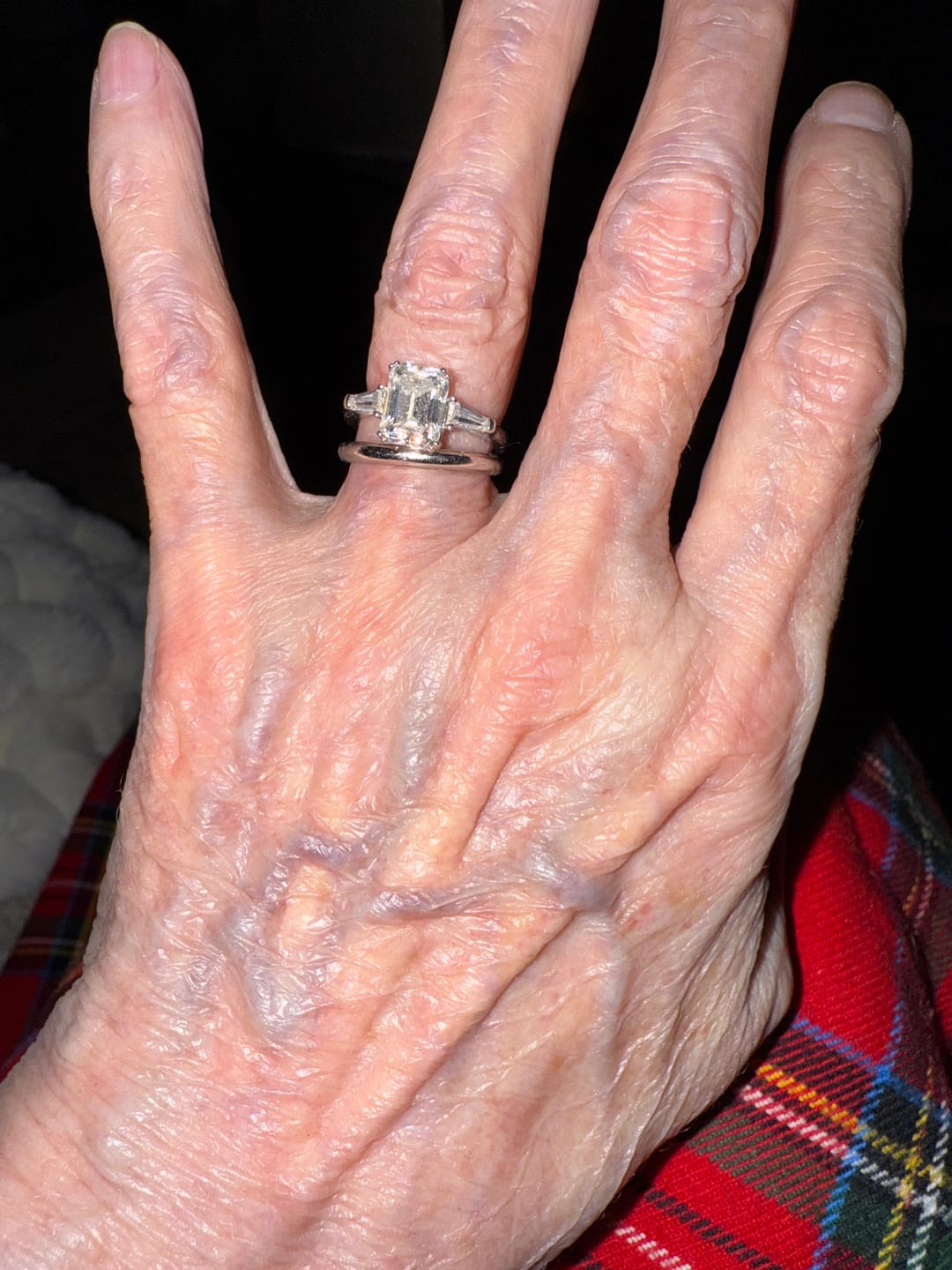 Customer photo review of Three Stone Emerald Cut Moissanite Tapered Baguette Engagement Ring