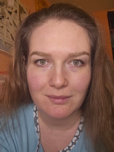 Customer photo review of Glov Micro Infusion System