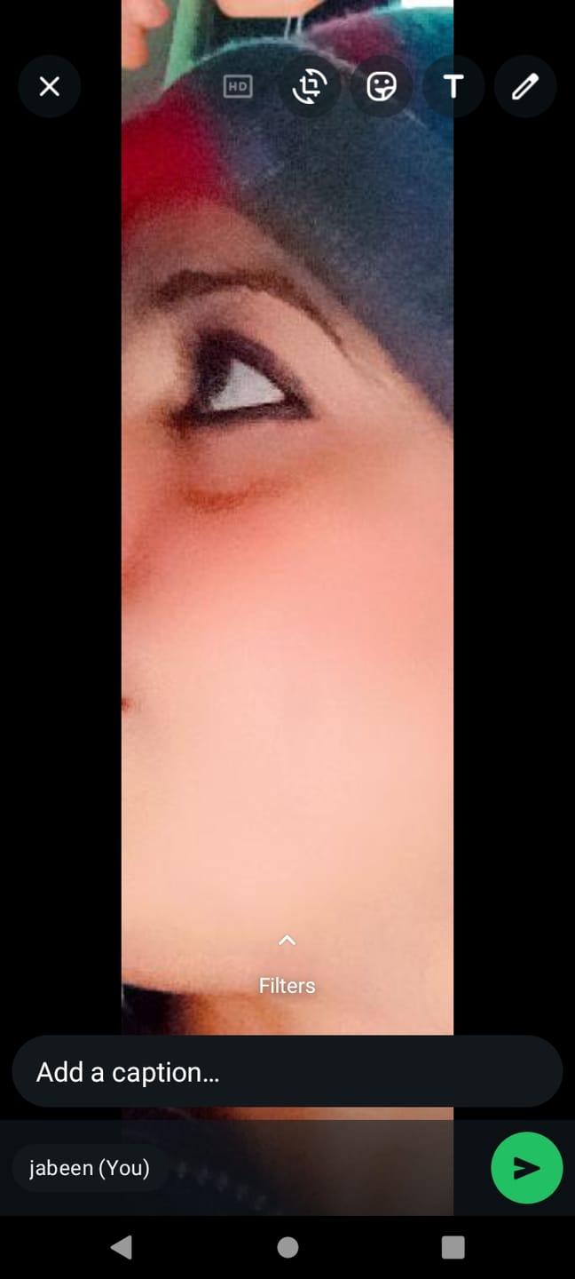 Customer photo review of SPECIAL PIGMENTATION BUNDLE (MELASMA, FRECKLES & DARK SPOTS)