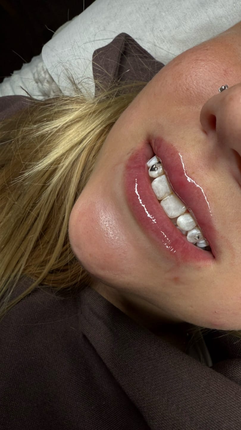 Customer photo review of Large Heart 24-karat gold
