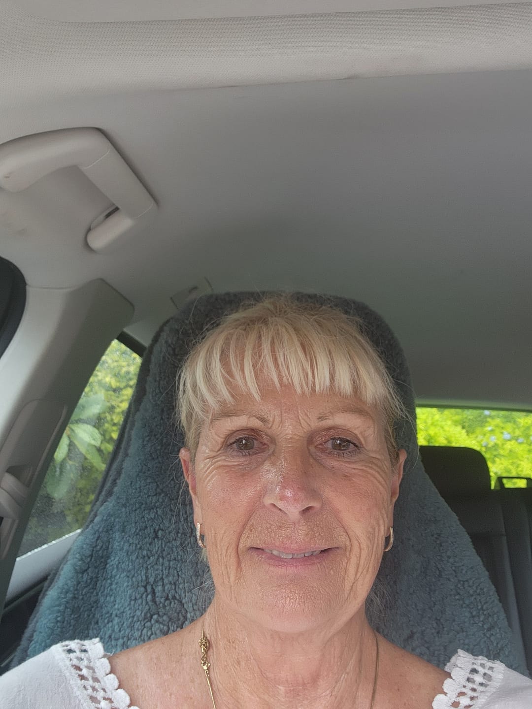 Customer photo review of Kakadu Brightening Serum (FREE) 25ml