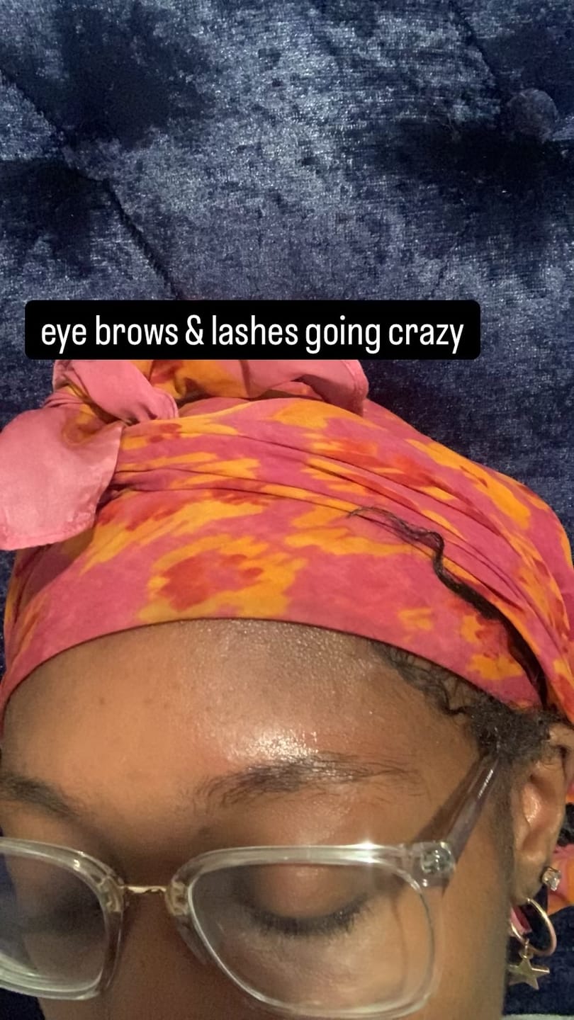 Customer photo review of Volume Eyebrow and Eyelash Serum -