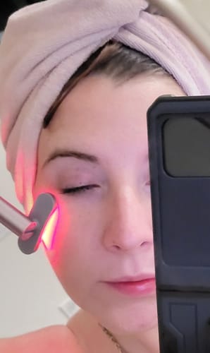 Customer photo review of 4-in-1 Skincare Wand