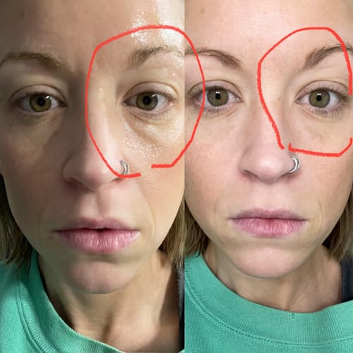 Customer photo review of 4-in-1 Skincare Wand