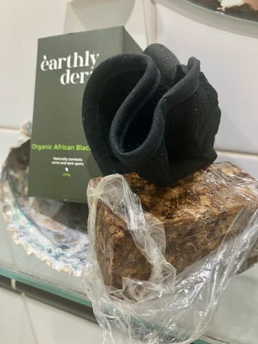 Customer photo review of Anti-Acne & Dark Spots African Soap