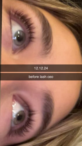 Customer photo review of PRE ORDER Lash Growth Serum- ADD TWO TO YOUR CART TO GET ONE AUTOMATICALLY FREE- est ship time 16th december