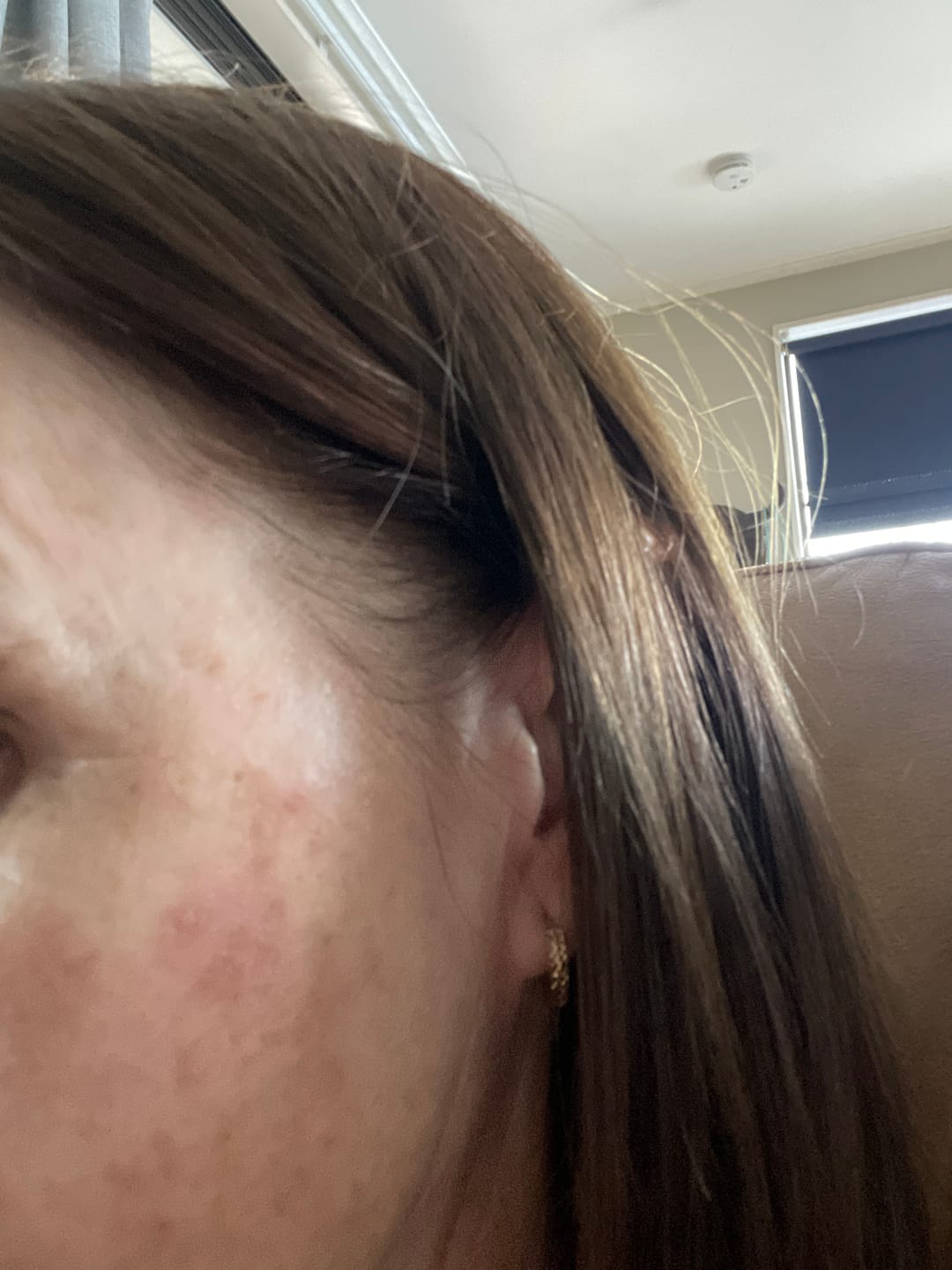Customer photo review of MAGNESIUM SUPER STICK