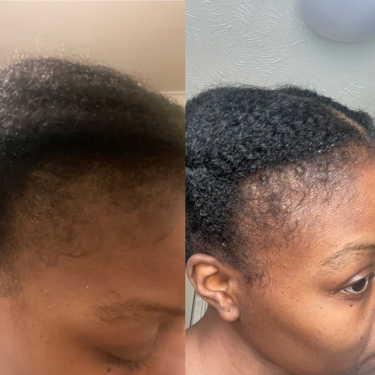 Customer photo review of Follicle Fuel Pro+ – Hair Growth Potion (Extra Strength)