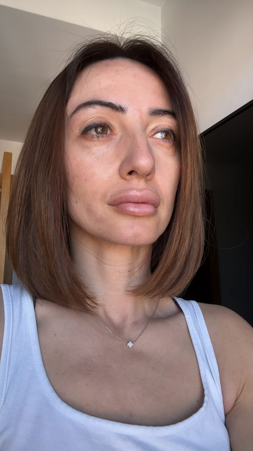 Customer photo review of The Ordinary Glycolic Acid 7% Toning Solution