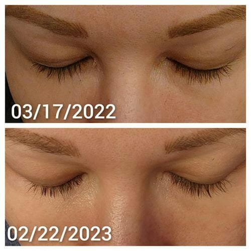 Customer photo review of NordicLash - Aktivator til øjenvipperødder