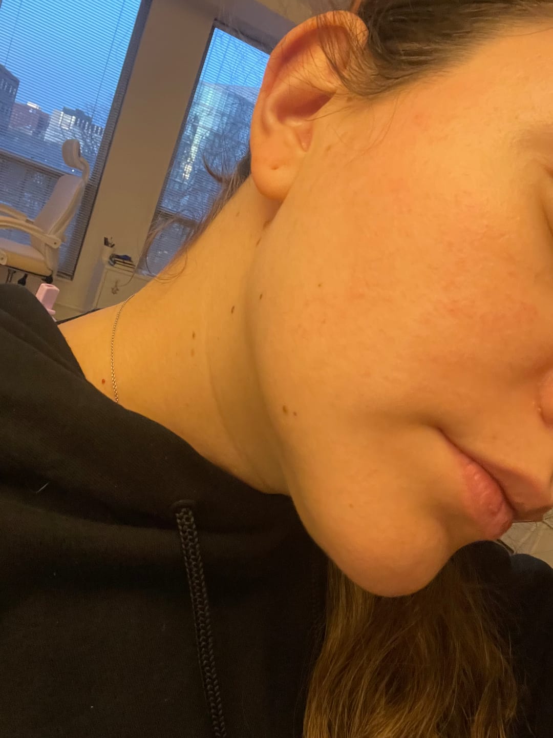 Customer photo review of The Plant Stem Cell Serum with Peptides