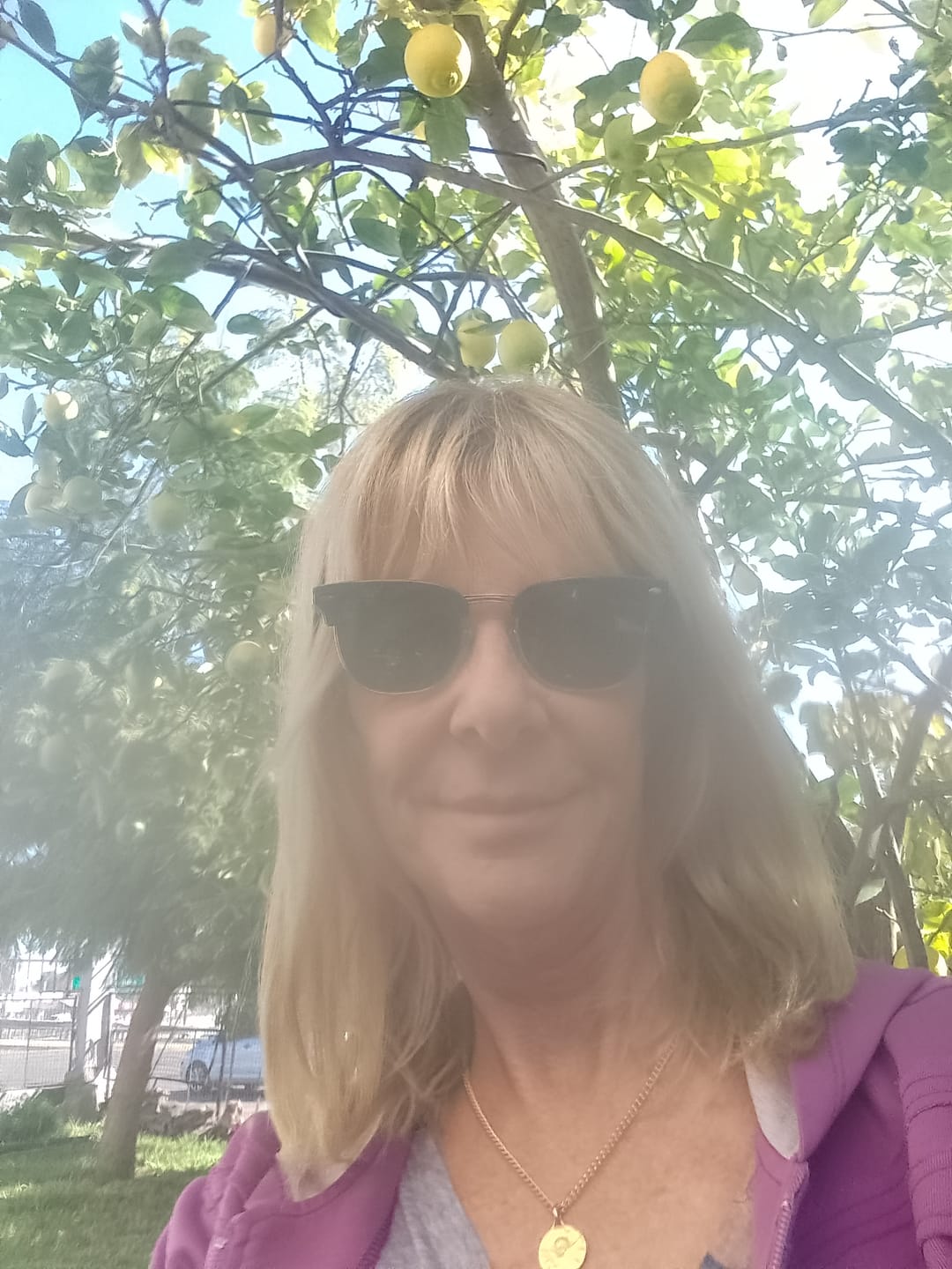 Customer photo review of Combo Anticaída - Shampoo, Acondicionador y Loción