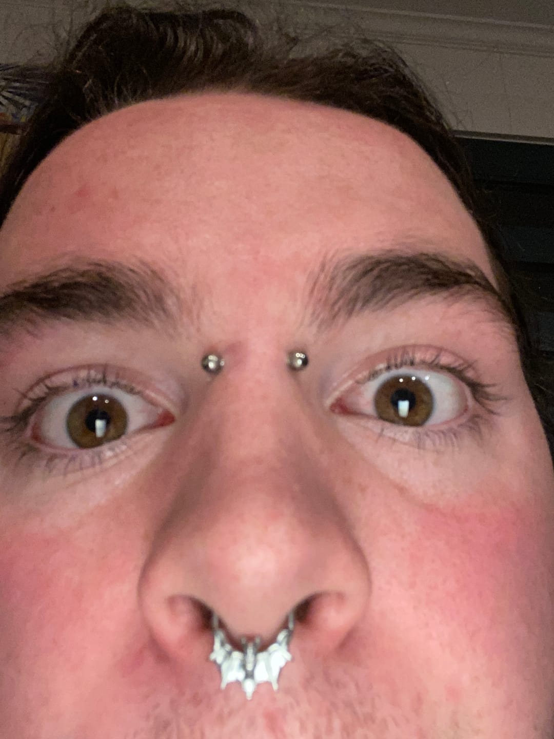 Customer photo review of BAT SEPTUM