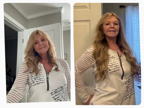 Customer photo review of Semaglutide Weight Loss Program